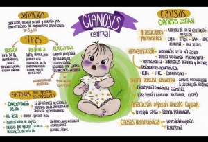 Cianosis central